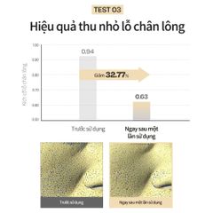 Nước Hoa Hồng Toner Serum d'Alba White Truffle 180ml - Dưỡng Ẩm, Chống Lão Hóa, Se Khít Lỗ Chân Lông Cho Da Nhạy Cảm