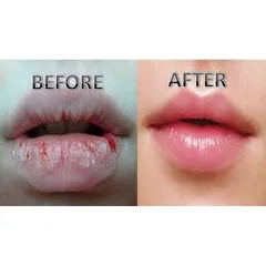 Son Dưỡng Môi Omi Menturm Nhật Bản - Chống Khô Nứt Nẻ, Dưỡng Ẩm Mềm Mại, Chiết Xuất Thiên Nhiên, An Toàn Cho Da Nhạy Cảm