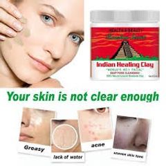 Mặt Nạ Đất Sét Aztec Secret - Bentonit 100g Giảm Mụn, Thải Độc Da, Làm Sáng Da - Dùng Với Giấm Táo Bragg, Sản Phẩm Chăm Sóc Da Hiệu Quả