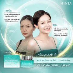 Kem Đêm Minta Melasma 50g - Dưỡng Trắng, Ngừa Nám Tàn Nhang, Cấp Ẩm Sâu, Ngăn Ngừa Lão Hóa Da