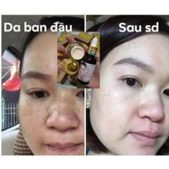 Combo 2 Bộ Kem Face Tái Tạo Da Gia Truyền - Giúp Da Căng Bóng Mịn Màng, Sạch Nám Mụn Tàn Nhang Chăm Sóc Da Mặt