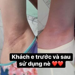Kem Giảm Thâm Nách CÔ BƠ 8g - Chuyên Dụng Khử Mùi, Dưỡng Sáng Da Vùng Nách,  Cho Da Nhạy Cảm, Sản Phẩm Việt Nam