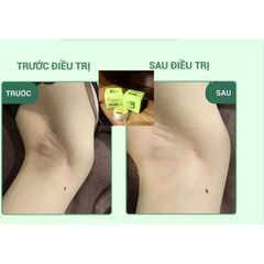 Combo 3 Hộp Kem Khử Thâm Nách & Hôi Nách Cô Bơ - Sáng Mịn Da 8gr - Giảm Thâm, Ngăn Mùi Hiệu Quả cho Tất Cả Đối Tượng