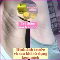 Combo 3 Hộp Kem Khử Thâm Nách & Hôi Nách Cô Bơ - Sáng Mịn Da 8gr - Giảm Thâm, Ngăn Mùi Hiệu Quả cho Tất Cả Đối Tượng