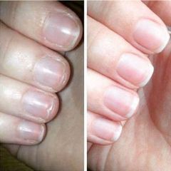 Dưỡng Móng Collagen Thiên Di - Phục Hồi Móng Yếu, Giúp Móng Cứng Khỏe, Nhanh Dài, Bóng Đẹp - Sản Phẩm Chăm Sóc Móng Thiên Nhiên