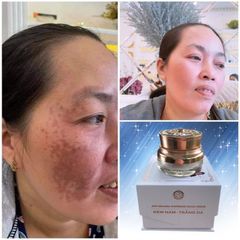 Kem Nám Saffron Chính Hãng - Mờ Thâm, Ngừa Nám, Dưỡng Trắng Da, Tăng Sinh Collagen, Làn Da Mịn Màng, Chống Lão Hóa