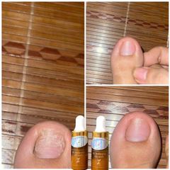 Serum Dưỡng Cứng Móng 4ml - Giải Quyết Nấm Móng, Hư Khoé, Bọng Móng - Sản Phẩm Gia Truyền Hiệu Quả