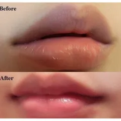 Son Dưỡng Môi Collagen Có Màu Dành Cho Bà Bầu - Giảm Thâm, Dưỡng Ẩm, Tăng Cường Màu Sau Phun Xăm, An Toàn, Thiên Nhiên, Không Chì
