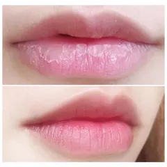 Son Dưỡng Môi Collagen Có Màu Dành Cho Bà Bầu - Giảm Thâm, Dưỡng Ẩm, Tăng Cường Màu Sau Phun Xăm, An Toàn, Thiên Nhiên, Không Chì