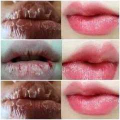 Son Dưỡng Môi Collagen Có Màu Dành Cho Bà Bầu - Giảm Thâm, Dưỡng Ẩm, Tăng Cường Màu Sau Phun Xăm, An Toàn, Thiên Nhiên, Không Chì