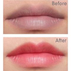 Combo Dưỡng Môi Thiên Di - Tinh Chất Cấy Màu Hồng Tự Nhiên, Tẩy Thâm, Chống Khô, Collagen Tăng Cường Độ Ẩm