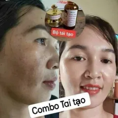 Combo 2 Hộp Kem Face Tái Tạo Da Gia Truyền Đông Y - Giúp Da Căng Bóng Mịn Màng, Sạch Nám Mụn Tàn Nhang