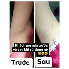 Kem Khử Mùi Hôi Nách Cô Bơ 30gr - Giảm Thâm, Ngăn Mồ Hôi, Dưỡng Trắng Da Nách - Dành Cho Mẹ Bầu và Trẻ Em Trên 10 Tuổi