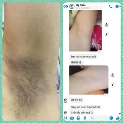 Kem Khử Mùi Hôi Nách Cô Bơ 30gr - Giảm Thâm, Ngăn Mồ Hôi, Dưỡng Trắng Da Nách - Dành Cho Mẹ Bầu và Trẻ Em Trên 10 Tuổi