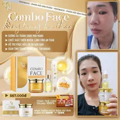 Combo 2 Kem Face Collagen X3 Chính Hãng - Dưỡng Trắng Da, Mờ Thâm Nám, Chống Nắng SPF 45 từ Mỹ Phẩm Đông Anh