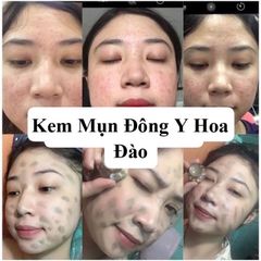 Kem Mụn Hoa Đào 2 Weeks - Dưỡng Da Trắng Hồng, Xóa Mụn, Mờ Vết Thâm, Chiết Xuất Thảo Dược Tự Nhiên, An Toàn Cho Tất Cả Loại Da