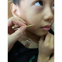 Gel Tẩy Nốt Ruồi Collagen Tại Nhà - Xóa Mụn Cơm, Đồi Mồi, Sẹo Lồi - Da Mịn Màng, Sạch Sẽ, Không Để Lại Sẹo