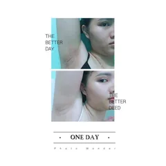 Combo 5 Hộp Kem Khử Thâm Nách Cô Bơ 8gr - Đánh Bay Hôi Nách, Làm Trắng An Toàn, Thơm Mùi Sâm, An Toàn Cho Mẹ Bầu