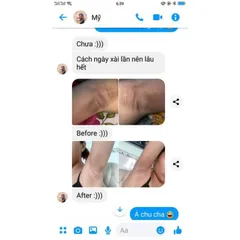 Combo 5 Hộp Kem Khử Thâm Nách Cô Bơ 8gr - Đánh Bay Hôi Nách, Làm Trắng An Toàn, Thơm Mùi Sâm, An Toàn Cho Mẹ Bầu