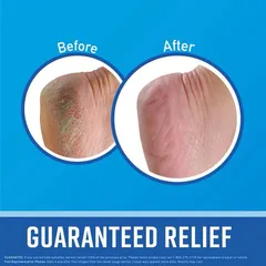 Kem Dưỡng Gót Chân O'Keeffe's Healthy Feet 76g - Khô Nứt, Giữ Ẩm Hiệu Quả, Chăm Sóc Đôi Chân Khỏe Mạnh, Hàng Mỹ