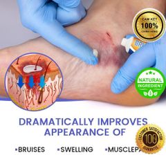 Kem Bôi Vết Bầm, Vết Thâm Dưới Da - Mega Care 100% Tự Nhiên, Giảm Sưng Tấy, Phục Hồi Da Tổn Thương Hiệu Quả