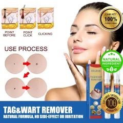 Bút Chấm Mụn Cóc và Nốt Ruồi EELHOE - Giải Pháp Tự Nhiên Loại Bỏ Mụn Thịt Thừa, Hiệu Quả Rõ Rệt Sau 2 Tuần Sử Dụng