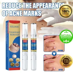 Bút Chấm Mụn Cóc và Nốt Ruồi EELHOE - Giải Pháp Tự Nhiên Loại Bỏ Mụn Thịt Thừa, Hiệu Quả Rõ Rệt Sau 2 Tuần Sử Dụng