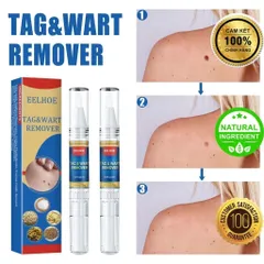 Bút Chấm Mụn Cóc và Nốt Ruồi EELHOE - Giải Pháp Tự Nhiên Loại Bỏ Mụn Thịt Thừa, Hiệu Quả Rõ Rệt Sau 2 Tuần Sử Dụng