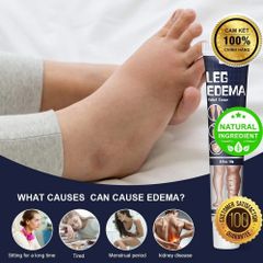 Kem Bôi Giảm Sưng Phù Nề Chân - Hỗ Trợ Thoát Dịch Từ Thiên Nhiên, Giúp Lưu Thông Khí Huyết Và Làm Dịu Cảm Giác Nặng Chân