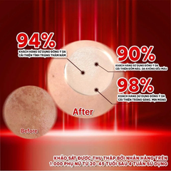 Kem Dưỡng Da Mờ Nám Tranexa Acid Angel's Liquid Mela Cream 50ml - Giúp Làm Sáng Da, Giảm Thâm Mụn, Phục Hồi Sắc Tố Da