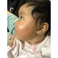 Kem Bôi Da Minh Hùng Chính Hãng - Chăm Sóc Da Bé, Tái Tạo Da, Chống Ngứa, Dành Cho Trẻ Sơ Sinh và Hỗ Trợ Điều Dị Ứng Da