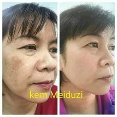 Combo Kem Dưỡng Trắng Da MEIDUZI Xanh Đỏ Ngày Và Đêm - Mờ Thâm Sạm, Nám Mụn 20Gram - Chăm Sóc Da Từ Thiên Nhiên Nhật Bản
