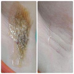 Wax Lông Lạnh Honey 350Gr - Bộ Triệt Lông An Toàn Không Đau Rát, Tặng 50 Giấy & 2 Que, Sạch Lông Lâu Mọc Lại