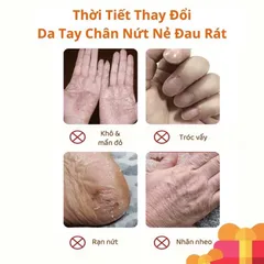 Kem Dưỡng Ẩm Chống Nẻ Da Heyxi 20g - Giúp Phục Hồi, Cấp Nước Cho Da Khô, Nứt Nẻ, Mịn Màng, Khỏe Mạnh