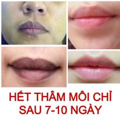 Dưỡng Môi Collagen Thiên Di - Khử Thâm, Dưỡng Hồng, Làm Mềm Mịn Môi, Chống Nắng Bảo Vệ Tia UV, Hiệu Quả Dài Lâu