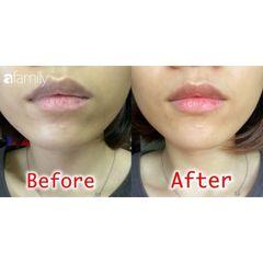Dưỡng Môi Collagen Thiên Di - Khử Thâm, Dưỡng Hồng, Làm Mềm Mịn Môi, Chống Nắng Bảo Vệ Tia UV, Hiệu Quả Dài Lâu