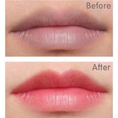 Dưỡng Môi Collagen Thiên Di - Khử Thâm, Dưỡng Hồng, Làm Mềm Mịn Môi, Chống Nắng Bảo Vệ Tia UV, Hiệu Quả Dài Lâu