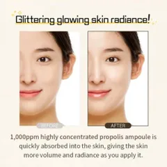 Tinh Chất Serum Keo Ong Wellderma Propolis 1000 - 50ml - Bí Quyết Cho Làn Da Sáng Khỏe, Căng Bóng