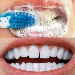 Kem đánh răng Sensodyne Advanced Whitening 184g - Giảm ê buốt, làm trắng răng hiệu quả cho người lớn và trẻ em trên 12 tuổi