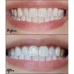 [ Date 2025] Kem đánh răng trắng răng Crest White Brilliance 99g