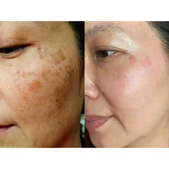 Kem Dưỡng Trắng Da MeSo Spa - Giúp Căng Bóng Da, Mờ Thâm Nám, Dưỡng Ẩm Mịn Màng, 30g