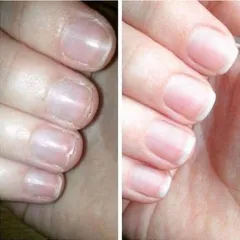 Dưỡng Móng Collagen Chắc Khỏe - Giúp Móng Nhanh Dài, Phục Hồi Móng Yếu, Sử Dụng Cho Tiệm Nail và Chăm Sóc Móng Tại Nhà