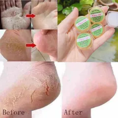 Kem Bôi Da Chống Nẻ Gót Chân Thẩm Thấu Nhanh - Dưỡng Ẩm Da Mềm Mịn Thiên Di, Hủ 8gr, Phù Hợp Mọi Loại Da