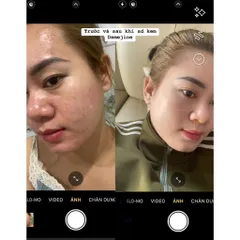 Kem Demejine Hàn Quốc - Kem Dưỡng Da Trắng Hồng, Ngày Đêm, Giảm Mụn Nám, Tái Tạo Da, Chống Lão Hóa - Sản Phẩm Chăm Sóc Da Đỉnh Cao 2024
