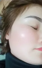 Kem Dưỡng Trắng Da MeSo 30g - Siêu Căng Bóng, Tái Tạo Da Mịn Màng, Mờ Thâm Nám Tàn Nhang, Dưỡng Ẩm Da Mướt