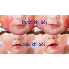 Kem Bôi Nứt Gót Chân Gia Truyền Thiên Di - Dưỡng Ẩm Da, Chống Nẻ, An Toàn Cho Trẻ Sơ Sinh, Bôi Chàm Sữa Hăm Tả
