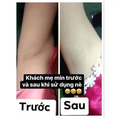 Combo 2 Hộp Kem Cô Bơ Khử Thâm Nách - Dưỡng Trắng & Giảm Mùi Hôi Hiệu Quả Cho Nam Nữ & Bà Bầu