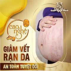 Cao Nghệ Đông Anh Collagen X3 50gr - Kem Dưỡng Da Trắng Sáng, Phục Hồi Da Chuyên Sâu, Làm Mờ Mụn, Nám, Thâm, Giúp Da Trẻ Hóa