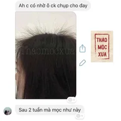 Xịt Dưỡng Tóc, Tinh Dầu Bưởi Mọc Tóc Thảo Mộc Xưa Kích Thích Mọc Tóc Con Giúp Tóc Nhanh Dài Giảm Gãy Rụng
