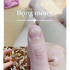 Serum Nấm Chăm Sóc Móng Tay Chân - Combo 5 Lọ Nước Ăn Dưỡng Cứng Móng, Điều Trị Bọng Móng và Hư Khe 4ml